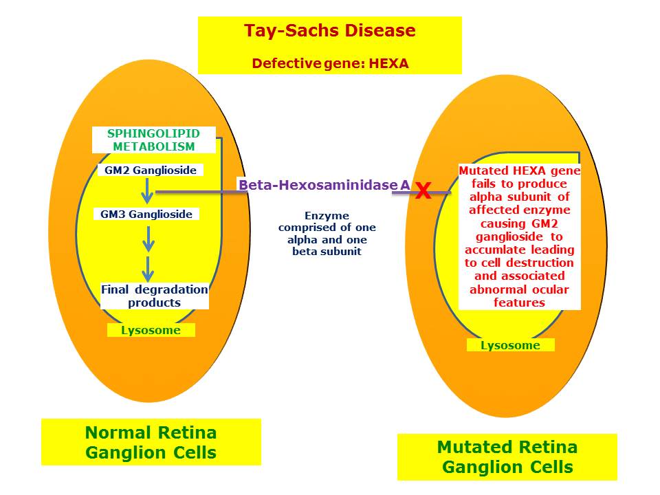 tay sachs disease is an example of a n
